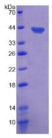 XCL1-2.jpg