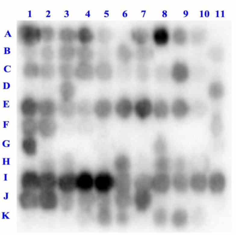 Binding of DPP-IV to deca-peptides derived from α-lactalbumin (A1–K4, ) and from other proteins (K5–K11, and ). The binding is inversely correlated to the light signal, the darkest spots representing peptides on which more enzyme was bound.