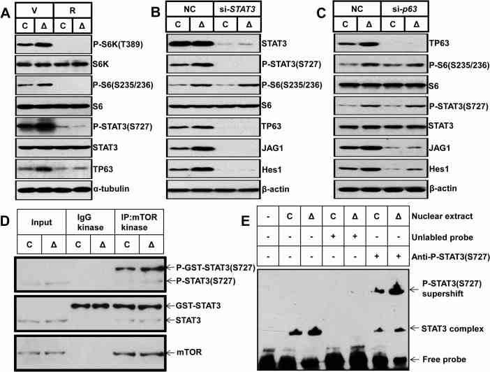 (A) Control and Δ Tsc1 primary calvarial cells were treated with vehicle (V) or 0.1 nM rapamycin (R) for 24 hours and then underwent immunoblotting to detect phosphorylation of STAT3 (Ser727) and TP63 (total p63). Control and Δ Tsc1 primary calvarial cells were treated with STAT3 (B) and p63 (C) siRNA and negative control (NC) for 48 hours and then underwent immunoblotting to detect mTORC1 activity, phosphorylation of STAT3(Ser727), TP63 (total p63) and activity of Notch pathway (JAG1, Hes1). (D) Cultured primary calvarial cells were immunoprecipitated with anti-mTOR antibody and the precipitated mTOR was assayed for kinase activity against recombinant GST-tagged full-length STAT3. (E) Nuclear extract from control and Δ Tsc1 primary calvarial cells were analyzed using EMSA. Binding of STAT3 to biotin-labeled DNA probes is shown as “STAT3 complex”. To compete with the binding, an unlabeled STAT3 binding site DNA probe was added to the reaction in 200 times molar excess. Adding anti-pSTAT3 (S727) antibody to the reactions caused reduction of STAT3-DNA binding and bands of supershift.