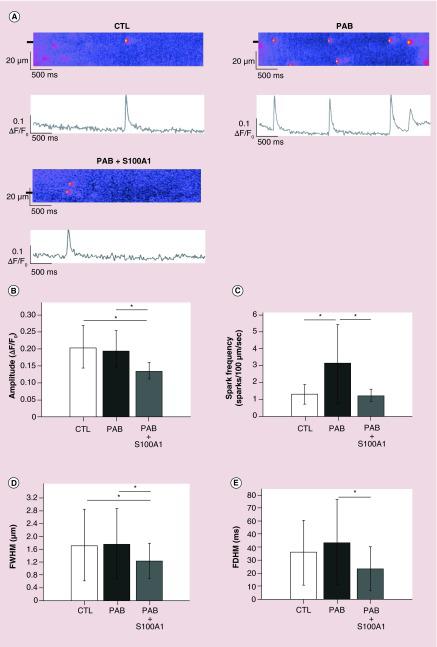 (A) Representative confocal line scans and the corresponding fluorescence profiles (ΔF/F0) of Ca2+ sparks from permeabilized rat myocytes from CTL, PAB or PAB treated with de-encapsulated S100A1 (PAB + S100A1). Fluorescent profiles were generated from the line scan regions marked by black boxes. (B–D) Summary data of the spark amplitude (B), spark frequency (C), full width at half maximum (D) and full duration at half maximum (E) measured from the three groups. CTL: n = 80 sparks from n = 7 rats; PAB: n = 212 sparks from n = 10 rats; PAB + S100A1: n = 33 sparks from n = 9 rats.