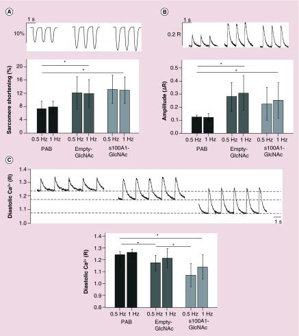 (A) Representative sarcomere shortening, (B) Ca2+ transient amplitude and (C) diastolic Ca2+ traces from PAB, empty-GlcNAc treated and S100A1-GlcNAc treated myocytes during 0.5 and 1 Hz electrical stimulation. Summary bar graphs are shown for each parameter below the traces. Sarcomere shortening is shown as the percentage change in sarcomere length during contraction. Ca2+ transient amplitude (ΔR) and diastolic Ca2+ (R) measurements were made in cells loaded with 10 μM of the ratiometric Ca2+ indicator fura-2/AM. Representative traces are from cells during (A & B) 1.0 Hz or (C) 0.5 Hz stimulation. PAB: n = 8–13 cells from n = 6 rats; empty-GlcNAc: n = 9–13 cells from n = 6 rats; S100A1-GlcNAc: n = 8–12 cells from n = 6 rats.
