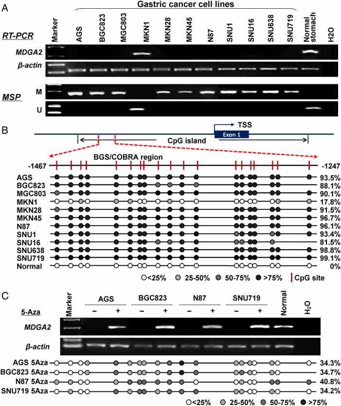 MDGA2 is inactivated by promoter methylation in gastric cancer cell lines. (A) MDGA2 was silenced or downregulated in 10 out of 11 gastric cancer cell lines but readily expression in normal gastric tissue. The methylation status of MDGA2 was determined by methylation-specific PCR (MSP). M, methylated; U, unmethylated. (B) A typical CpG island is present at the promoter region of MDGA2. Each vertical bar represents a single CpG site. The transcription start site (TSS) is indicated by a curved arrow. A region for bisulfite genomic sequencing (BGS) and combined bisulfite restriction analysis (COBRA) is denoted. BGS analysis confirmed high levels of promoter methylation in MDGA2-silenced cells and no/low methylation in MDGA2-expressing samples. (C) MDGA2 mRNA expression was restored after treatment with the demethylation reagent 5-Aza. Decreased methylation was revealed by BGS after 5-Aza treatment.
