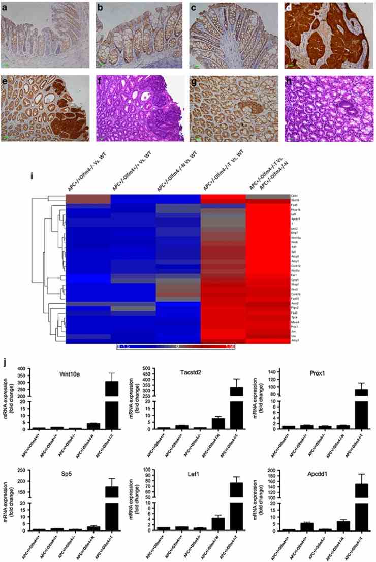 Olfm4 deletion enhances Wnt/β-catenin signaling in Apc Olfm4 double-mutant mice. ( a–h ) β-Catenin immunohistochemistry staining was performed in the distal colon of Apc +/+ Olfm4 +/+ (WT) ( a ), Apc +/? Olfm4 +/+ ( b ), Apc +/+ Olfm4 ?/? ( c ), Apc +/? Olfm4 +/? ( d ) and Apc +/? Olfm4 ?/? ( e and g ) mice. Hematoxylin and eosin (HE) staining in ( f and h ) was performed in mice corresponding to ( e and g ), respectively. Scale bar, 50 μm. ( i ) A heatmap from cDNA microarray analysis shows Wnt pathway-related or target gene-expression level in the distal colon of mice with different genotypes. N, tumor-adjacent normal tissue; T, tumor. ( j ) Mean (±s.d.) ( n =3) gene-expression levels for six representative Wnt target genes were confirmed by qRT–PCR. See also and .