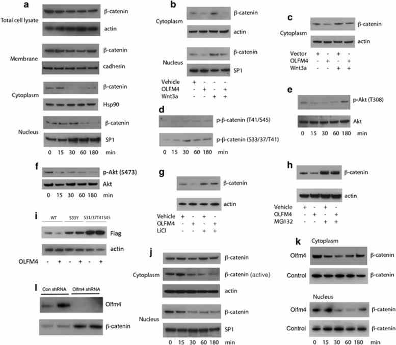 OLFM4 decreases β-catenin levels. ( a–k ) Western blots were performed in 293T cells ( a–i ), SW480 cells ( j ) and freshly isolated mouse colon crypts ( k ) after human OLFM4 treatment (1 μg/ml) ( a–j ) and mouse Olfm4 treatment (1 μg/ml) ( k ). β-Actin, total cadherin, Hsp90 and SP1 were used as loading controls in total cell lysate, membrane, cytoplasm and nucleus cell preparations, respectively. ( a ) β-Catenin levels in total cell lysate, membrane, cytoplasm and nucleus at different time points of OLFM4 treatment. ( b ) Endogenous and Wnt3a (1 μg/ml)-induced β-catenin levels in the cytoplasm and nucleus of cells pretreated with and without OLFM4 for 30 min. ( c ) Endogenous and Wnt3a (1 μg/ml)-induced β-catenin levels in the cytoplasm of cells transfected with control (vector) or OLFM4 expression plasmid. ( d ) β-Catenin phosphorylation at different time points of OLFM4 treatment. ( e and f ) Akt (T308 or Ser473) phosphorylation at different time points of OLFM4 treatment. ( g and h ) β-Catenin levels in the cytoplasm of cells pretreated with and without either LiCl (20 m m ) or MG132 (10 μ m ) before OLFM4 treatment for 30 min. ( i ) β-Catenin levels in total cell lysates of cells transfected with Flag-tagged WT or mutant (S33Y or S31/37T41S45) β-catenin expression plasmids and then treated with or without OLFM4 for 30 min. ( j ) Total and active β-catenin levels in the cytoplasm or nucleus of SW480 colon-cancer cells at different time points of Olfm4 treatment. ( k ) β-Catenin levels in the cytoplasm and nucleus of freshly isolated mouse colon crypts at different time points of Olfm4 (or PBS control buffer) treatment. ( l ) Olfm4 and β-catenin levels in the cytoplasm of Ls174T cells infected with lentiviral control shRNA and Olfm4 shRNA.