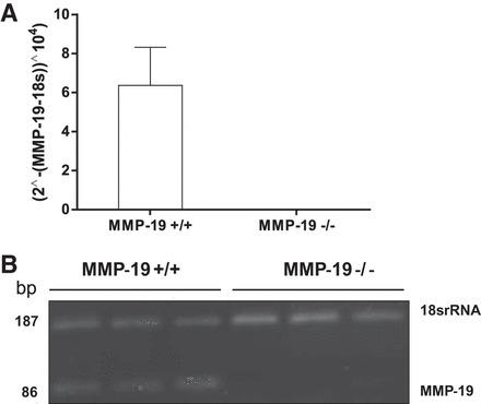 Mmp19 gene expression in Mmp19?/? and Mmp19+/+ fibroblasts. The expression of matrix metalloproteinase 19 (MMP-19) was evaluated by quantitative RT-PCR (A) and RT-PCR (B) in 3 different fibroblast cell lines from each genotype. Each cDNA was quantified in triplicate.