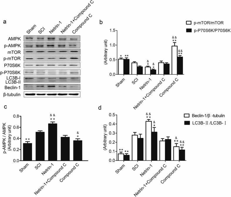 (a) Expression of AMPK, p-AMPK, mTOR, p-mTOR, p-P70S6K, P70S6K, Beclin-1, LC3B, and β-tubulin in the sham, SCI, Netrin-1, Netrin-1+ compound C, and compound C groups. (b,c,d) Quantification analysis of p-mTOR/mTOR p-P70S6K/P70S6K, p-AMPK/AMPK, LC3B-II/LC3B-I, and Beclin-1/β-tubulin in each group. Mean ± SD, n = 3. *P < 0.05 vs. the SCI group; **P < 0.01 vs. the SCI group; & P < 0.05 vs. the Netrin-1+ compound C group; && P < 0.01 vs. the Netrin-1+ compound C group.