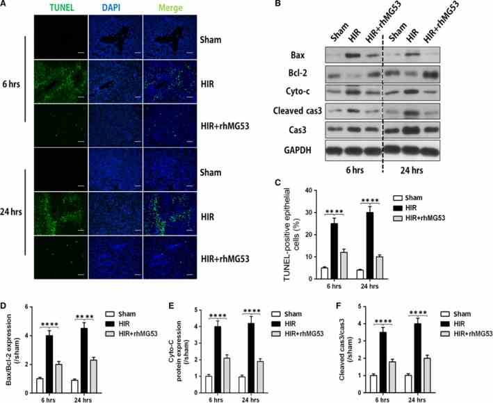 Protective effects of rhMG53 were related to hepatic apoptosis inhibition. Rats were subjected to HIR or sham operation with or without administration of rhMG53 via caudal vein and then samples were collected after liver reperfusion for 6 and 24 hrs. ( A ) Terminal deoxynucleotidyl transferase‐mediated nick‐end labelling (TUNEL) staining (×200) of liver; ( B ) Bax/Bcl‐2, caspase 3/cleaved caspase 3 and cytochrome c (Cyto‐ c ) protein expression; ( C ) percentage of TUNEL‐positive cells; ( D and F ) density analysis of Bax/Bcl‐2, caspase 3/cleaved caspase 3 and cytochrome c (Cyto‐ c ) protein expression. Date are mean ± SEM, n = 8/group, ** P < 0.01. HIR, hepatic ischaemia/reperfusion; rhMG53, recombinant human MG53 protein.