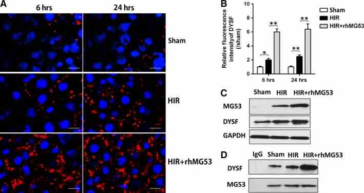 rhMG53 attenuated hepatic ischaemia/reperfusion injury via interaction with dysferlin. Rats were subjected to HIR or sham operation with or without administration of rhMG53 via caudal vein and then samples were collected after liver reperfusion for 6 and 24 hrs. ( A and B ) Immunofluorescence staining (×400) of liver dysferlin (DYSF) (Red) and nucleus (blue) and density analysis; ( C ) Western blot assay on liver dysferlin and MG53 at 6 hrs after reperfusion. ( D ) Immunoprecipitation assay of dysferlin/MG53 at 6 hrs after reperfusion. Date are mean ± SEM, n = 8/group, * P < 0.05, ** P < 0.01. HIR, hepatic ischaemia/reperfusion; rhMG53, recombinant human MG53 protein.