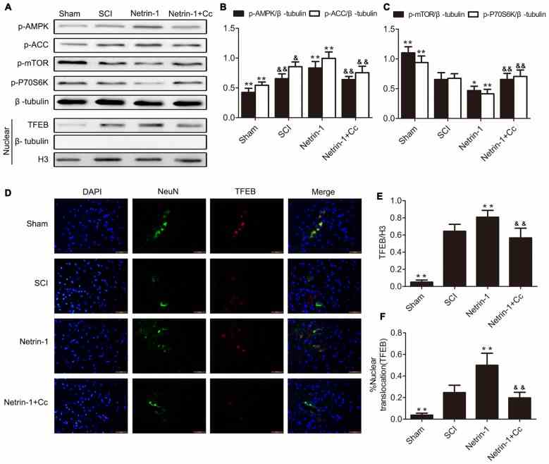 Netrin-1-promotes transcription factor EB (TFEB) nuclear translocation via the AMP-activated protein kinase/mammalian target of rapamycin (AMPK/mTOR) signal pathway after spinal cord injury (SCI). (A) Western blots of p-AMPK, p-Acetyl-CoA Carboxylase (p-ACC), p-mTOR, p-P70S6K, TFEB, H3 and β-tubulin in each group. (B,C,E) Quantification of p-AMPK, p-ACC, p-mTOR, p-P70S6K, TFEB, H3 and β-tubulin in each group ( n = 5). (D) Double staining for NeuN (green)/TFEB (red) of sections from the spinal cord in each group. (F) Quantification of the nuclear-translocation neurons of TFEB in each group ( n = 5); * P < 0.05 vs. SCI group, ** P < 0.01 vs. SCI group, & P < 0.05 vs. Netrin-1 group && P < 0.01 vs. Netrin-1 group.