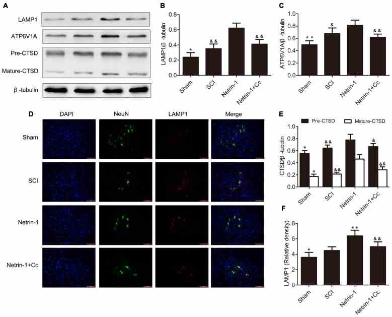 Netrin-1 enhances lysosomal biogenesis after SCI. (A) Western blots of lysosomal-associated membrane protein 1 (LAMP1), ATP6V1A, CTSD (Pre-CTSD and Mature-CTSD) and β-tubulin in each group. (B,C,E) Quantification of LAMP1, ATP6V1A, CTSD (Pre-CTSD and Mature-CTSD) and β-tubulin in each group ( n = 5). (D) Double staining for NeuN (green)/LAMP1 (red) of sections from the spinal cord in each group. (F) Quantification of the number of LAMP1-positive neurons in each group ( n = 5); * P < 0.05 vs. SCI group, ** P < 0.01 vs. SCI group, & P < 0.05 vs. Netrin-1 group && P < 0.01 vs. Netrin-1 group.