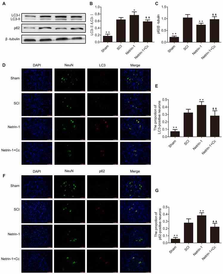 Netrin-1 promotes autophagy flux after SCI. (A) Western blots of light chain 3 (LC3)-I, LC3-II, p62 and β-tubulin in each group. (B,C) Quantification of LC3-I, LC3-II, p62 and β-tubulin in each group ( n = 5). (D) Double staining for NeuN (green)/LC3 (red) of sections from the spinal cord in each group (white arrows: LC3-positive neurons). (E) Quantification of the number of LC3-positive neurons in each group ( n = 5). (F) Double staining for NeuN (green)/p62 (red) of sections from the spinal cord in each group. (G) Quantification of the number of p62-positive neurons in each group ( n = 5). * P < 0.05 vs. SCI group, ** P < 0.01 vs. SCI group; && P < 0.01 vs. Netrin-1 group.