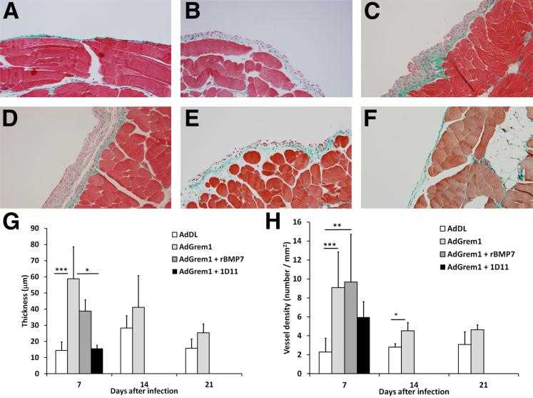 Histologic analysis of the anterior abdominal wall after exposure to AdDL or AdGrem1 in B6 mice. A: Normal peritoneal structure seen 7 days after AdDL. B–D: Increased submesothelial thickening and fibrosis 7, 14, and 21 days after exposure to AdGrem1. E: In animals treated with AdGrem1 and rBMP7, there is ongoing submesothelial thickening and angiogenesis. F: There is a decrease in submesothelial thickening in animals treated with AdGrem1 and 1D11. Sections were stained with Masson's trichrome. G–H: Quantitation of submesothelial histological examination in B6 mice exposed to AdDL or AdGrem1. G: Significantly increased submesothelial thickening is seen after exposure to AdGrem. The submesothelial thickening is significantly reduced by treatment with 1D11. H: Submesothelial angiogenesis seen in the peritoneal tissues of B6 mice exposed to AdGrem1 is not prevented by treatment with rBMP7 or 1D11. n = 4 for control (AdDL) group; n = 6 for treatment groups at each time point. Data are expressed as means ± SD (G and H). ?P < 0.05, ??P < 0.01, and ???P < 0.001. Original magnification: ×100 (A–F).