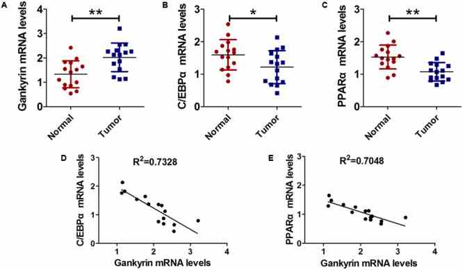Gankyrin expression was increased and negatively correlated with C/EBPα and PPARα levels in liver cancer tissues. (A–C) QRT-PCR analysis was performed to detect the expression of C/EBPα (A) , PPARα (B) , and gankyrin (C) in liver cancer and cancer-adjacent normal tissues. n = 15, ? P < 0.05, ?? P < 0.01, cancer tissue vs. adjacent normal tissue. (D) Association between gankyrin levels and C/EBPα expression levels. (E) Association between gankyrin levels and PPARα expression levels.