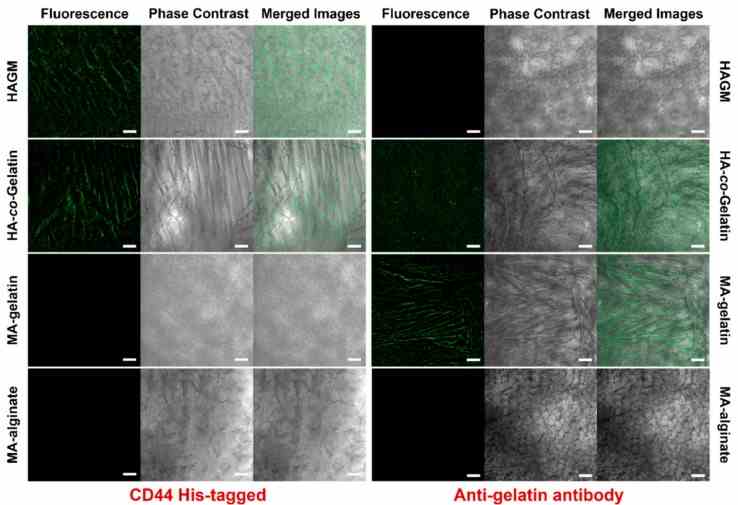 Evaluation of biological properties of cryogels. Immunostaining of HAGM, MA-gelatin, HA- co -Gelatin, and MA-alginate cryogels using human CD44 His-tagged receptor and anti-gelatin antibody. CD44 binding was depicted with an Alexa Fluor 488-conjugated 6x-His Tag monoclonal antibody (green), and anti-gelatin antibody binding was detected with a FITC-conjugated anti-rabbit IgG (green) (scale bar = 100 μm).
