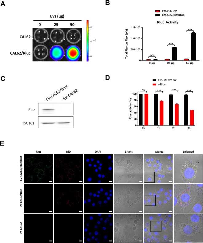 EV-CAL-62/Rluc showed EV-specific Rluc activity and serum stability in vitro . ( A ) Representative bioluminescent imaging of an in vitro luciferase assay in EVs from CAL-62 and CAL-62/Rluc cells. ( B ) Quantitative in vitro luciferase data in EVs are expressed as the mean ± SD. ( C ) Western blot analysis of the Rluc protein in EVs from CAL-62, CAL-62/Rluc cells, detected by means of Rluc-specific antibodies. TSG served as loading control. ( D ) Stability of Rluc in EV-CAL62/Rluc and recombinant Rluc protein in serum. Time course of stability of Rluc at 37 °C in 20% FBS/PBS buffer. ( E ) Representative confocal images of Rluc (green) and DiD (red) in EV-CAL62/Rluc/DiD or EV-CAL62/DiD or EV-CAL62 in CAL62 cells. Scale bars: 10 μm.