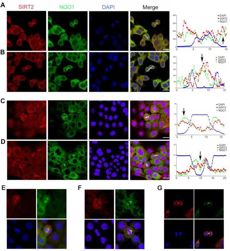 NQO1 and SIRT2 colocalize to the mitotic spindle during mitosis. (A, B) Confocal microscopy images show the locations of endogenous SIRT2 (red) and NQO1 (green) during both metaphase (A) and telophase (B) in MCF-7 human breast cancer cells. (C, D) Confocal microscopy images show the locations of endogenous SIRT2 (red) and NQO1 (green) during both metaphase (C) and telophase (D) in BxPC-3 human pancreatic cancer cells. In all panels above, DNA was stained with DAPI (blue). On the right, graphs represent signal intensity scans along the lines drawn for each panel. Scale bar, 20 μm. (E, F, G) Higher magnification images (60x) under same experimental conditions as shown in A, B.