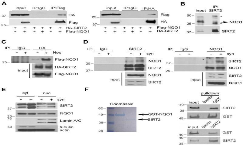 NQO1 interacts directly with SIRT2. (A) MCF-7 cells were transiently transfected with Flag-NQO1 and HA-SIRT2. 48 h after transfection, cell lysates were subjected to immunoprecipitation (IP) using either a Flag (left) or an HA (right) antibody followed by western blotting using antibodies against HA and Flag, respectively. Specificity was confirmed by using species-matched control IgG as a negative control. (B) Cell lysates from MCF-7 cells were subjected to immunoprecipitation (IP) using a SIRT2 antibody followed by western blotting using an anti-NQO1 antibody. * denotes Ig heavy and light chain. (C) Cell lysates from MCF-7 cells as described in (A) either unsynchronized or synchronized in mitosis after treatment with nocodazole (Noc, 200 nM for 12 h) were subjected to immunoprecipitation using an antibody against HA followed by western blotting using a Flag antibody. Specificity was confirmed by using species-matched control IgG as a negative control. Overexpression of both Flag-NQO1 and HA-SIRT2 is confirmed by western blotting (lower). (D) Reciprocal co-immunoprecipitation of endogenous SIRT2 and NQO1 in either unsynchronized or synchronized in mitosis Hela cells. For cell synchronization, HeLa cells were serum starved for 48 h and then released into regular media for 16 h. Cell lysates were subjected to immunoprecipitation (IP) using either a SIRT2 (left) or an NQO1 (right) antibody followed by western blotting using antibodies against SIRT2 and NQO1. Specificity was confirmed by using species-matched control IgG as a negative control. (E) Either unsynchronized or synchronized in mitosis (syn, as described in C) MCF-7 cells were fractionated into cytoplasmic extracts (cyt) and nuclear extracts (nuc). Levels of both SIRT2 and NQO1 were detected by western blotting. Successful cellular fractionation was confirmed by western blotting using antibodies against markers such as Lamin A/C (nuc) and actin (cyt). (F) Recombinant human SIRT2 and GST-NQO1 were used to check protein-protein interaction in vitro. Coomassie staining shows the molecular weight of the two proteins. GST-NQO1 was immunoprecipitated followed by SIRT2 immunodetection of (upper). In addition, SIRT2 was immunoprecipitated first, followed by immunodetection of GST-NQO1 (lower). Beads alone were used in the pull-down assays as negative controls.