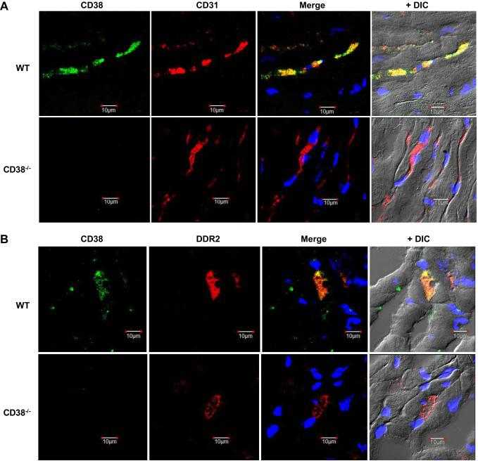 CD38, CD31, and DDR2 immunostaining in heart tissue. A: CD38 (green) and endothelial cell marker CD31 (red) were stained in WT and CD38?/? (KO) heart sections. Using a differential interference contrast (DIC) image, CD31 is seen to strongly and selectively stain vascular endothelium. CD38 colocalized with CD31 in the WT heart sections, with merging of the two images yielding a strong yellow color. As expected, no CD38 staining is seen in KO. B: CD38 (green) and fibroblast marker DDR2 (red) were stained in WT and CD38?/? heart sections (KO). Some colocalization of CD38 and DDR2 was observed in WT sections, with no CD38 in KO.