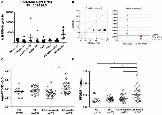 Association between anti-PFDN5 antibody and AS with uveitis. (A) Protein microarray analysis of autoreactivity to PFDN5 in sera from patients with various autoimmune diseases in the Multiple Autoimmune Disease Genetics Consortium Cohort. (B) Receiver operating characteristic curve for anti-PFDN5 as a biomarker of uveitis in AS. (C) ELISA analysis of anti-PFDN5 antibody levels in sera from Korean cohort. (D) ELISA analysis of PFDN5 protein levels in sera from Korean cohort. Data presented as mean ± SEM. * p < 0.05; ** p < 0.01, by Mann–Whitney U -test. PFDN5, prefoldin subunit 5; RA, rheumatoid arthritis; CCP, cyclic citrullinated protein; JIA, juvenile idiopathic arthritis; PsA, psoriatic arthritis; PAH, pulmonary artery hypertension; AUC, area under the curve; HC, healthy control; ELISA, enzyme-linked immunosorbent assay; ns, not significant.