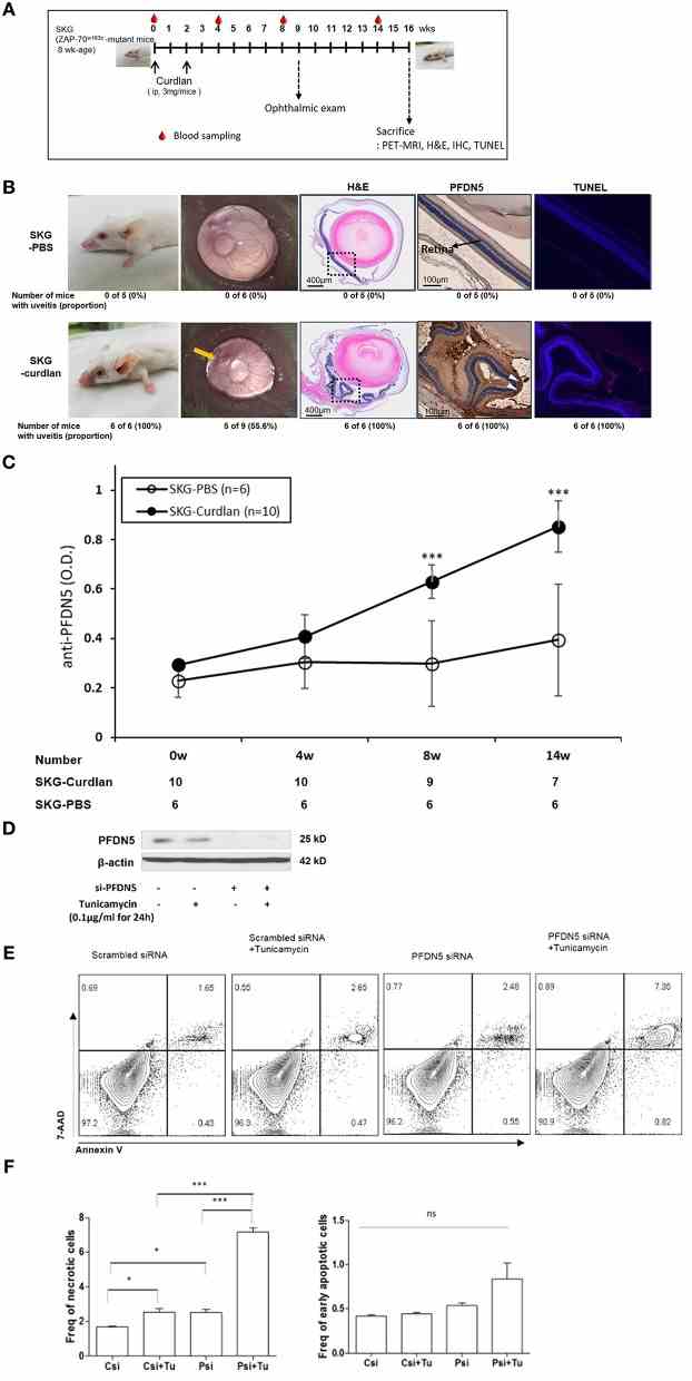 Expression of PFDN5 in curdlan-treated SKG mice with ocular lesions, and the role of PFDN5 against apoptosis in ARPE19 cells. (A) The experimental design. (B) Comparison of gross phenotype, microscopic ophthalmologic exam, H&E staining, IHC, and TUNEL assay between PBS-treated SKG mice and curdlan-treated-SKG mice. (C) ELISA analysis of anti-PFDN5 antibody levels in sera of PBS-treated SKG mice and curdlan-treated SKG mice according to the number of weeks post-injection. (D) Western blot showing protein expression of PFDN5 in ARPE19 cells transfected with non-targeting scrambled siRNA, scrambled siRNA with tunicamycin stimulation, siRNA against PFDN5 , and si- PFDN5 with tunicamycin stimulation. (E) Representative flow cytometry plot of 7-AAD and annexin V staining for ARPE19 cells transfected with non-targeting scrambled siRNA, scrambled siRNA with tunicamycin stimulation, siRNA against PFDN5 , and si- PFDN5 with tunicamycin stimulation. (F) Comparison of the proportion of necrotic cells or early apoptotic cells among ARPE19 cells transfected with scrambled siRNA, scrambled siRNA under tunicamycin stimulation, si-PFDN5 and si-PFDN5 under tunicamycin stimulation. Data presented as mean ± SEM. * p < 0.05; *** p < 0.001, by Mann–Whitney U -test. H&E, hematoxylin and eosin; PFDN5, prefoldin subunit 5; IHC, immunohistochemistry; TUNEL, Terminal deoxynucleotidyl transferase dUTP Nick-End Labeling; ELISA, enzyme-linked immunosorbent assay; ARPE19, retinal pigment epithelial 19; 7-AAD, 7-aminoactinomycin D; ns, not significant.