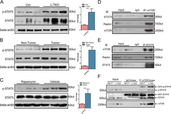 Hepatic p-STAT5 was determined by western blots in L-TKO mice and control littermates ( a ), and in tumor and nontumor areas of L-TKO mice ( b ). c Liver tissues were lysed from rapamycin or vehicle treated 10-month-old L-TKO mice, and p-STAT5 was determined by western blots ( n = 6). Western blots were quantified. *** P < 0.001. d HepG2 cells were immunoprecipitated with anti-mTOR antibody and the amounts of Raptor, and STAT5 co-purified with mTOR were determined by western blot. e HepG2 cells were immunoprecipitated with anti-STAT5 antibody and the amounts of mTOR and Raptor co-purified with STAT5 were determined by western blot. f Cultured hepatocytes cells from Ctrl and L-TKO mice were immunoprecipitated with anti-mTOR antibody and the precipitated mTOR was assayed for kinase activity against recombinant GST-tagged full-length STAT5