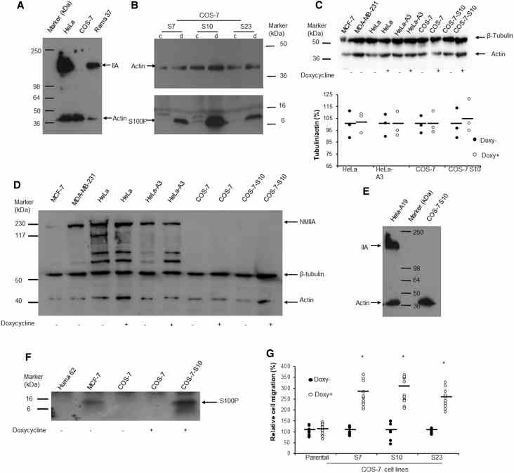 ( A ) Western blot with anti-nonmuscle myosin IIA and anti-β-actin. There was no band at 226 kDa corresponding to nonmuscle myosin IIA (IIA) in monkey COS-7 cells compared to that seen in human HeLa and rat Rama 37 cells. The gels have been overexposed to detect even the smallest trace of NMIIA. ( B ) Three clones of S100P-inducible COS-7 cells (S7, S10, S23) were exposed to 0 (c) or 1 μg/ml (d) doxycycline for 24 h. Western blot of equal amounts of loaded proteins shows relative S100P levels. In addition to monomeric S100P at an apparent mol wt of 10 kDa (arrow), multimeric forms can also be seen in these overexposed gels. ( C ) Effects of doxycycline on the abundance of tubulin. Upper panel: Typical Western blot for β-tubulin and actin in cell lines treated without (Doxy?) or with (Doxy+) 1 μg/ml doxycycline for 24 h using both rabbit anti-β-tubulin (Abcam) and rabbit anti-actin (Abcam) (Methods). Lower panel: the relative percentage (%) ratios of band densitites of tubulin/actin in dot plots with bars representing means showed no significant difference between paired doxycycline-treated cells and control cells (Students t -test, P > 0.05). ( D ) NMIIA abundance in cell lines. Western blot was performed simultaneously using rabbit anti-nonmuscle myosin IIA (NMIIA) (Abcam), rabbit anti-β-tubulin (Abcam) and rabbit anti-actin (Abcam) to detect protein levels of NMIIA, β-tubulin and actin in cell lines as indicated from cultures treated without (?) or with (+) 1 μg/ml doxycycline for 24 h (Methods). No NMIIA was detected in the COS-7 cell lines under either condition. MCF-7 produced NMIIA, but at a lower level than MDA-MB-231 and HeLa cell lines. Extra, perhaps nonspecific protein bands were seen in HeLa cells with this anti-NMIIA antibody. ( E ) Western blot for NMIIA (IIA) and actin in S100P-inducible HeLa-A19 and COS-7 S7 S10 cells treated for 24 h with 1 μg/ml doxycycline. There was no band corresponding to NMIIA in treated or untreated COS-7 cells S10 cells. ( F ) S100P abundance in cell lines. Western blot was performed using anti-S100P antibody (R&D Systems) 1/1000 on cell lysates from cultures of Huma 62 (Human Breast benign cell line for negative control), MCF-7, COS-7 parental cells without (?) or with (+) 1 μg/ml doxycycline for 24 h and COS-7-S10 (S100P-inducible) cells with (+) doxycycline under the same conditions (Methods). S100P protein was detected only in MCF-7 and COS-7-S10 treated with doxycycline. ( G ) Cell migration assay of parental COS-7 (set at 100%) and COS-7 S7, S10 and S23 cells in the absence (Doxy?) or presence (Doxy+) of 1 μg/ml doxycycline for 24 h in dot plots with bars representing means. *Student's t -test, P < 0.01 when compared with non-induced control.