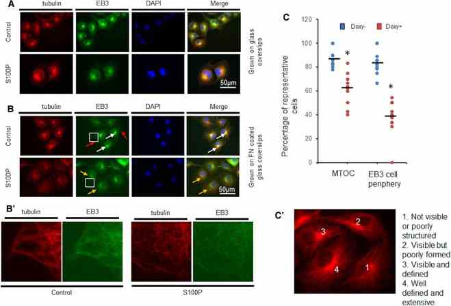 COS-7 S10 cells were induced for 48 h with 1 μg/ml doxycycline (S100P) or left untouched (Control) prior to seeding on ( A ) glass or ( B ) fibronectin (FN)-coated glass coverslips. After a further 48 h incubation in the same but fresh media, cells were dually immunofluorescently stained with TRITC-labelled antibodies to tubulin and FITC-labelled antibodies to End Binding Protein 3 (EB3). Nuclei were counterstained blue with DAPI. Typical images are presented. White arrows indicate the well-defined mitotic organising centres (dMTOC), red arrows indicate the clear EB3 bundles at cellular periphery. Yellow arrows indicate the MTOC that are not well-defined by EB3 staining. Bars = 50 μm. Images in B′ correspond to the enlarged regions of the highlighted cells. ( C ) The number of well-defined mitotic organising centres (dMTOC) or EB3 bundles at the cellular periphery were counted and the percentage of cells containing such structures are presented as dot plots with bars representing means. *Student's t -test, P < 0.001 when S100P expressing cells (Doxy+) were compared with controls (Doxy?). Images in C′ correspond to the quantification of how formed MTOC were quantified with cells showing (1) not visible or poorly structured organisation; (2) visible but poorly formed; (3) visable and defined; and well defined and extensive regions (Methods). Both MTOC organisation and EB3 localisation at the cell periphery were disrupted when S100P is expressed.