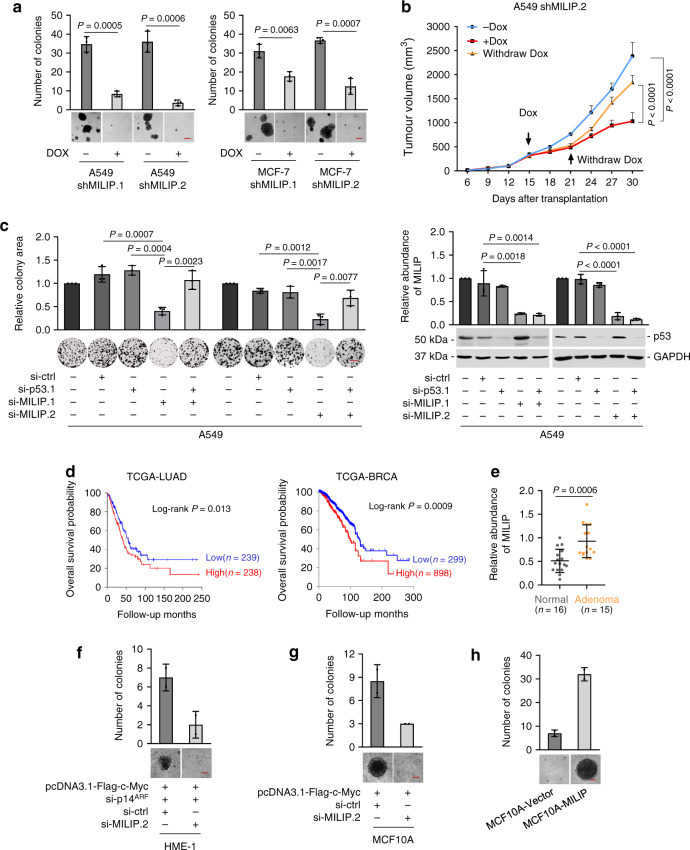 a Induced knockdown of MILIP by DOX reduced cancer cell anchorage-independent growth. Scale bar, 50 μm. Data are representatives or mean ± s.d.; n = 3 independent experiments, two-tailed Student’s t test. DOX: 200 ng/mL. b Induced knockdown of MILIP by DOX retarded A549 xenograft growth, which was reversed by DOX withdrawal in nu/nu mice. Data are mean ± s.d.; n = 6 mice per group, one-way ANOVA followed by Tukey’s multiple comparison test. DOX: 2 mg/mL supplemented with 10 mg/mL sucrose in drinking water. c MILIP silencing reduced A549 cell clonogenicity, which was attenuated by co-silencing of p53 siRNA1. Scale bar, 1 cm. Data are representatives or mean ± s.d.; n = 3 independent experiments, one-way ANOVA followed by Tukey’s multiple comparison test. d Kaplan–Meier analysis of the probability of overall survival (OS) of lung adenocarcinoma (LUAD; n = 477) and breast invasive carcinoma (BRCA; n = 1197) derived from the TCGA using the median/quartile of MILIP levels as the cut-off. e MILIP expression was increased in colon adenomas ( n = 15) compared with normal colon epithelia ( n = 16). Data are mean ± s.d.; two-tailed Student’s t test. f MILIP silencing decelerated anchorage-independent growth of HME-1 human mammary epithelial cells caused by c-Myc overexpression along with knockdown of p14 ARF . Scale bar, 50 μm. Data are representatives or mean ± s.d.; n = 2 independent experiments. g MILIP silencing decelerated anchorage-independent growth of MCF10A human mammary epithelial cells that did not express p14 ARF caused by c-Myc overexpression. Scale bar, 50 μm. Data are representatives or mean ± s.d.; n = 2 independent experiments. h MILIP overexpression caused anchorage-independent growth of MCF10A cells. Scale bar, 50 μm. Data are representatives or mean ± s.d.; n = 2 independent experiments. Source data of Fig. are provided as a Source Data file.