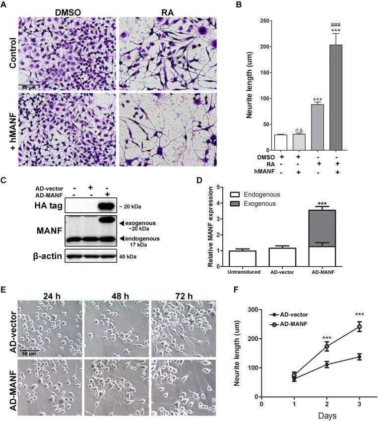 MANF overexpression facilitates RA-induced neurite outgrowth. (A) Representative images of N2a cells treated with DMSO or RA for 3 days with or without addition of recombinant hMANF (100 ng/ml). Cells were fixed and stained with crystal violet for visualization. (B) Average neurite length was measured, and analyzed by One-way ANOVA followed with the Tukey’s post hoc test, *** P < 0.0001 and n.s. not statistically significant compared to DMSO treated cells, ### P < 0.0001 compared to RA treated cells. The data were expressed as the mean ± SEM of three independent experiments. (C) Cells were lysed 48 h after adenovirus transduction and subjected to immunoblot to determine levels of MANF and HA tag expression. The size of the proteins (kDa) was labeled next to each band. (D) Endogenous and exogenous MANF protein levels were quantified and normalized to β-actin. The data were analyzed by Student’s t test, *** P < 0.0001. The data were expressed as the mean ± SEM of three independent experiments. (E) Representative images of AD-vector and AD-MANF transduced cells treated with RA for 24, 48, and 72 h. (F) Average neurite length of AD-vector and AD-MANF transduced cells after RA treatment was determined, and analyzed by Two-way ANOVA followed with the Bonferroni’s post hoc test, *** P < 0.001. The data were expressed as the mean ± SEM of three independent experiments.