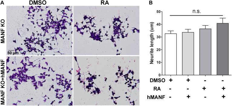 Addition of extracellular hMANF fails to rescue the neurite outgrowth defects in MANF KO cells. (A) Representative images of MANF KO N2a cells treated with DMSO or RA for 3 days with or without addition of recombinant hMANF (100 ng/ml). Cells were fixed and stained with crystal violet for visualization. (B) Average neurite length was measured, and analyzed by One-way ANOVA followed with the Tukey’s post hoc test, n.s. not statistically significant. The data were expressed as the mean ± SEM of three independent experiments.