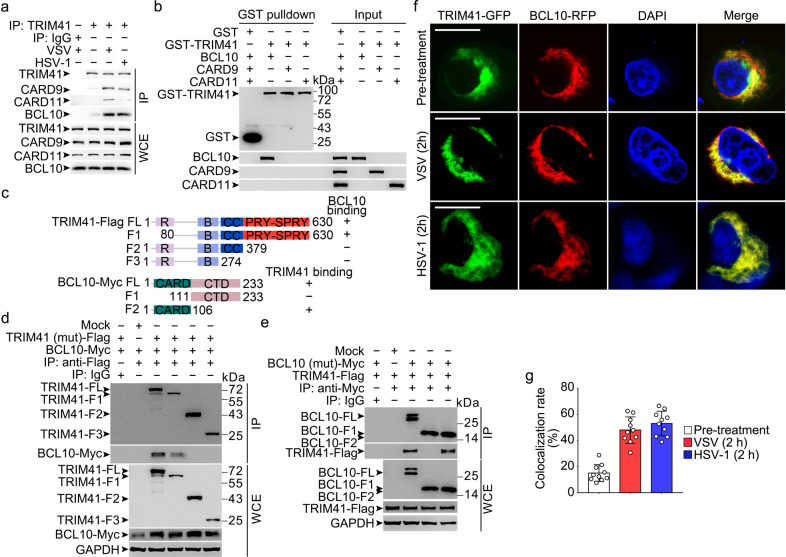 The PRY-SPRY domain of TRIM41 directly binds the CARD domain of BCL10. a Wild type BMDM were infected with VSV (MOI = 1) or HSV-1 (MOI = 5) viruses for 2 h as indicated. Then whole cell extracts (WCE) were immunoprecipitated with anti-TRIM41 antibody plus protein A/G beads. Components in the TRIM41 complex were examined by Western blotting. b 1 μg GST or GST-TRIM41 was coincubated with 1 μg recombinant CARD9, CARD11, or BCL10 for 1 h. Then sepharose 4B beads were used to pull down the GST complex. Components pulled down by the beads were examined by Western blotting. c Schematic illustration of domains in full-length (FL) or fragments (F) of TRIM41-Flag or BCL10-Myc. R, ring finger domain; B, B-box domain; CC, coiled-coil domain; CTD, C-terminal domain. Numerical numbers indicate the site of amino acids. d , e HEK293T cells were transiently transfected with Flag-tagged TRIM41 (or mutants) and Myc-tagged BCL10 (or mutants) as indicated for 48 h. Whole cell extracts (WCE) were immunoprecipitated with anti-Flag Sepharose Beads ( d ) or anti-Myc Sepharose Beads ( e ), and the associated BCL10 or TRIM41 was examined by Western blotting. f , g RAW264.7 cells grown on cover slides were transiently transfected with green fluorescent protein (GFP)-tagged TRIM41 and red fluorescent protein (RFP)-tagged BCL10 for 48 h, and then infected with VSV (MOI = 1) or HSV-1 (MOI = 5) viruses for 2 h. After counterstained with DAPI, cells were examined by confocal microscope ( f ; Scale bar, 100 nm). Ten double-positive randomly-selected cells on cover slides were measured for fluorescence colocalization, and the data are presented as mean ± SD ( g )
