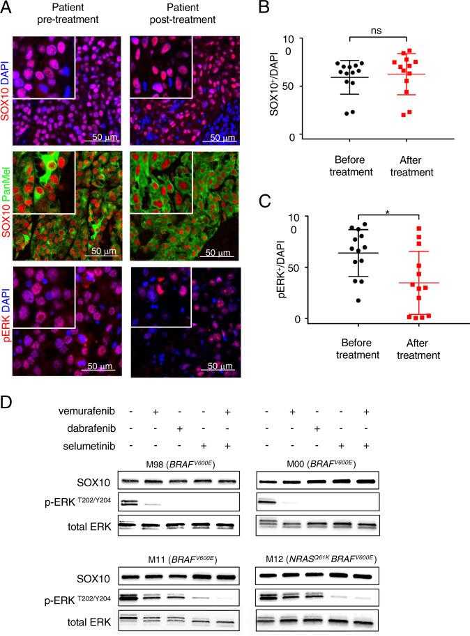 a Representative images of immunohistochemical stainings of human melanoma patient derived biopsies ( n = 13) before (left panel) and after (right panel) combined BRAF and MEK inhibitor treatment stained for SOX10 (red), pERK (red) and Pan Melanoma (PanMel), a cocktail of Melanoma antigen recognized by T cells-1 (MART-1) and Tyrosinase (green). Nuclei were counterstained with DAPI (blue). b Quantification of SOX10 expression levels pre- and post-BRAF and MEK inhibitor treatment. c Quantification of pERK expression levels pre- and post-BRAF and MEK inhibitor treatment. d Representative western blot for the indicated proteins in four different human melanoma cell lines. Levels of SOX10 expression are not decreased upon treatment with BRAF inhibitors (vemurafenib and dabrafenib, each 1 μM) or MEK inhibitor (selumetinib, 1 μM) after 24 h neither in single, nor in double treatments (vemurafenib and selumetinib). In MAPK inhibitor sensitive cell lines (M98, M00) pERK levels are not detectable anymore, which indicates the correct function of the drugs, whereas in resistant cell cultures (M11, M12) pERK levels were not affected ( n = 3). In b and c data represent mean ± s.d. Statistical significance was determined by paired, two-tailed Student’s t test. * P < 0.05, ** P < 0.01, *** P < 0.001 Western blots shown in d are representative. In each panel, n indicates the number of independent experiments performed.