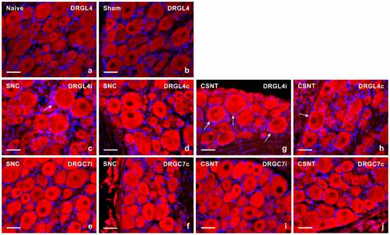 Representative sections of DRG from naive rat ( a ) and rats with sterile sham- ( b ), SNC- ( c – f ) or CSNT- ( g – j ) interventions for 7 days. The DRG sections of lumbar (DRG-L4) and cervical (DRG-C7) segments of both ipsilateral ( i ) and contralateral ( c ) sides were immunostained for TLR9 using a rabbit polyclonal antibody and donkey TRITC-conjugated anti-rabbit secondary antibody under the same conditions. Besides neuronal bodies, increased TLR9 immunofluorescence was found in satellite glial cells enveloping the neuronal bodies of ipsilateral DRG-L4 after SNC (arrow in c) and bilaterally in DRG-L4 after CSNT (arrows in g,h). Scale bars = 40 μm.