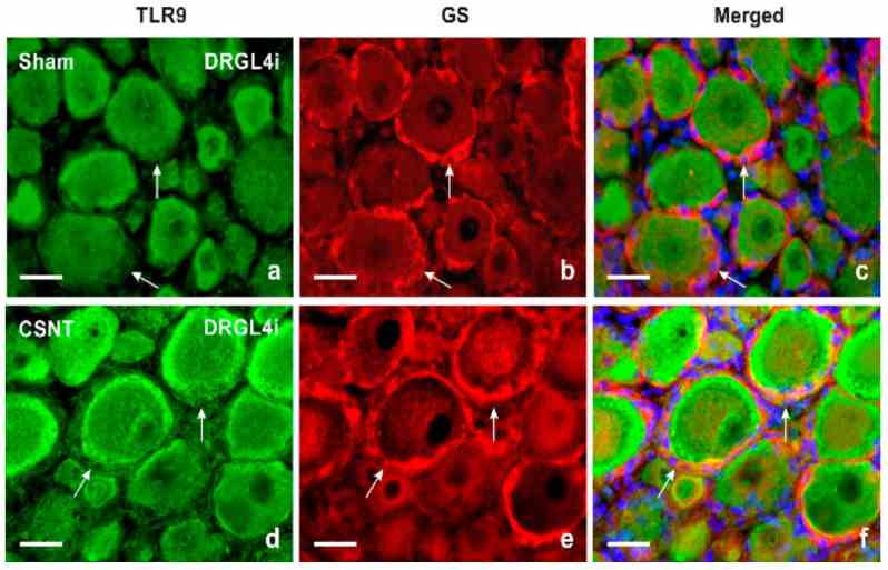 Double immunofluorescence staining for TLR9 and GS as a marker of satellite glial cells (SGCs). Sections of lumbar DRG ipsilateral (DRGL4i) to sham operation (Sham) and CSNT were immunostained with a mixture of rabbit polyclonal anti-TLR9 ( a , d ) and mouse monoclonal anti-GS ( b , e ) antibodies. Immunostaining was visualized with TRITC-conjugated donkey anti-rabbit and FITC-conjugated donkey anti-mouse secondary antibodies. Cell nuclei were detected with Hoechst 33342. Merged pictures ( c , f ) show no TLR9 immunostaining in SGCs of DRG from sham-operated rat (arrows in c), while SGCs enveloping large-sized neuronal bodies in DRG from CSNT-operated rat displayed clear TLR9 immunofluorescence (arrows in f). Scale bars = 20 μm.