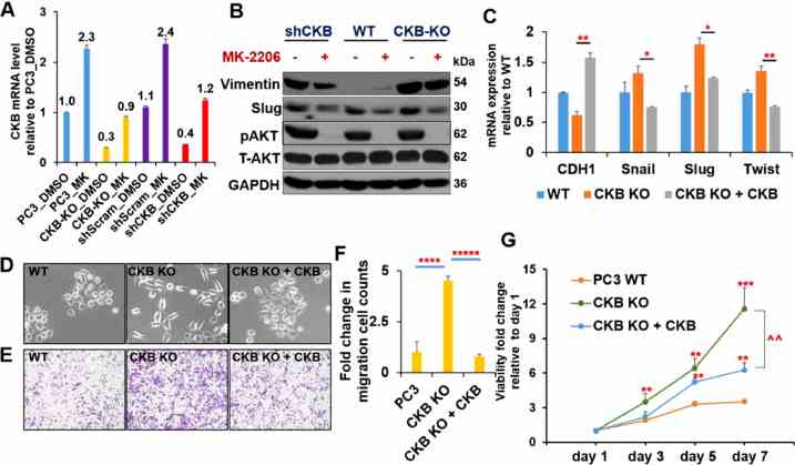 AKT inhibitor and CKB overexpression reverse EMT induced by CKB suppression. (A) RT-qPCR result of CKB expression in the indicated 4 cell lines treated with DMSO or 15uM AKT inhibitor MK-2206 for 24 h. Expression pattern for epithelial marker Occludin from these experiments is in Figure S4B. (B) Parental PC3 cells (wild type, WT), PC3 with CKB CRISPR-Cas9 knockout (CKB KO), or PC3 with CKB knockdown (shCKB-1) were treated with DMSO or 3uM of AKT inhibitor MK-2206 for 48h. Immunoblots for indicated proteins were shown. (C) qPCR analysis for indicated genes normalized to beta-Actin in PC3 parental cells (WT), CKB knockout cells (CKB KO), and CKB-knockout cells re-expressing CKB cDNA (CKB KO + CKB). * P < 0.05, ** P < 0.01 comparing CKB KO to CKB KO + CKB. (D) Cell morphology were monitored by phase-contrast microscopy in PC3 WT, CKB KO and CKB KO + CKB cells. (E) Boyden chamber migration assay for PC3 WT cells, PC3 CKB KO cells and PC3 CKB KO + CKB cells. (F) Quantitative results of the migrations in E, based on triplicates. *** P < 0.001, **** P < 1 × 10 ?4 , ***** P < 1 × 10 ?5 . (G) Alamar blue cell proliferation assay for PC3 WT, CKB KO and CKB KO + CKB cells cultured in media with reduced FBS (1.25%) at day 1, 3, 5 and 7 (quadruplicates). ** P < 0.01, *** P < 0.001 comparing CKB KO cells, CKB KO + CKB cDNA cells with WT cells at corresponding time points. ^^ P < 0.01 comparing CKB KO with CKB KO + CKB cells at day 7. These experiments have been repeated at least twice, which has yielded same conclusions. Results from a representative experiment are shown.