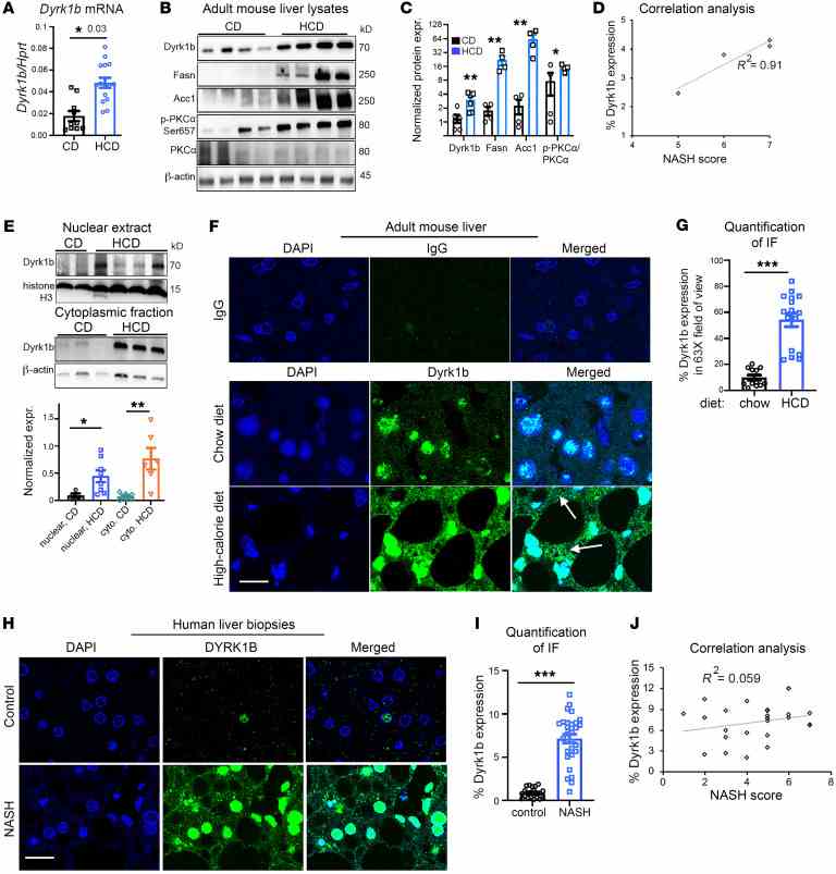 ( A ) Dyrk1b transcripts normalized to Hprt in the indicated conditions. Henceforth, each dot in the dot plots represents biological replicates; n > 8 mice each, unpaired t test, 2-tailed. ( B and C ) Western blot (WB) analysis and quantification of specified liver proteins in mice fed CD or HCD. Henceforth, each lane of WBs represents biological replicates; n = 4 mice each, unpaired t test, 2-tailed. ( D ) Correlation analysis between NASH score and Dyrk1b expression in the liver of HCD-fed mice. ( E ) WB and quantification of Dyrk1b levels in the nuclear (top) and cytoplasmic extracts (bottom) in the liver of mice fed with CD or HCD; n > 6 each, unpaired t test, 2-tailed. ( F and G ) Dyrk1b protein expression visualized by immunofluorescence in the liver of CD- or HCD-fed mice. IgG was used as control (top row); n = 5 mice each group. Arrows indicate cytoplasmic expression. Unpaired t test, 2-tailed. ( H and I ) Representative images and quantification of DYRK1B expression in the liver biopsies of patients with NASH versus controls; n = 20 controls, n = 27 NASH samples, unpaired t test, 2-tailed, Welch-corrected. ( J ) Correlation analysis between NASH score and percentage Dyrk1b expression in the human NASH samples ( n = 22) from I . Scale bars: 20 μm. * P ≤ 0.05, ** P ≤ 0.01, *** P ≤ 0.001.