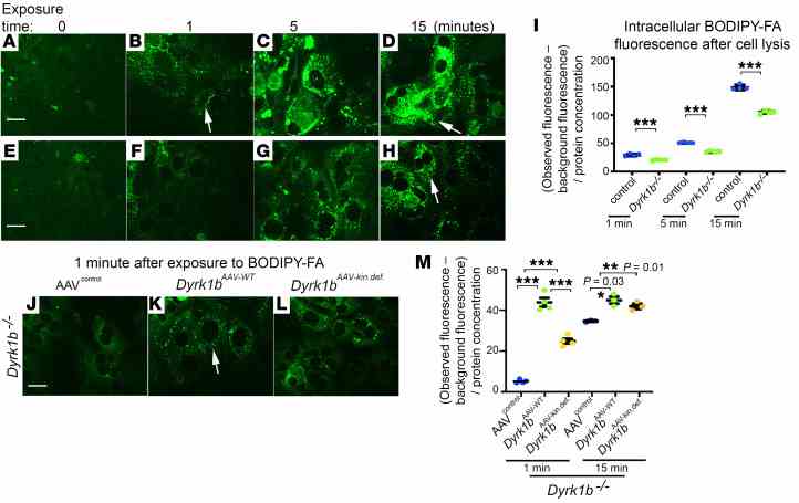 ( A – H ) Representative confocal images from littermate controls and Dyrk1b –/– hepatocytes at indicated time points after addition of BODIPY-FA; n = 5 mice each genotype, n = 4 technical replicates. ( I ) Quantification of intracellular fluorescence in controls and Dyrk1b –/– hepatocytes measured by the microplate reader after cell lysis at the indicated time points. The background fluorescence (prior to addition of BODIPY-FA) was subtracted and normalized to the total protein content. Unpaired t test, 2-sided, n = 5 mice each genotype, n = 4 technical replicates. ( J – L ) Representative confocal images showing BODIPY-FA uptake 1 minute after addition in Dyrk1b –/– hepatocytes transduced with AAV8 containing empty vector (AAV control ) or Dyrk1b WT or Dyrk1b kin.def virus, at an MOI of 60. The FA uptake experiment was performed 72 hours after virus transduction, to allow for sufficient transcription. n = 2 mice each condition, n = 4 technical replicates. ( M ) Quantification of intracellular fluorescence, in the indicated genotypes; 1-way ANOVA, Tukey’s post hoc test. White arrows indicate the intracellular fluorescence detected by BODIPY-FA. Scale bars: 150 μm. ** P ≤ 0.01, *** P ≤ 0.001.