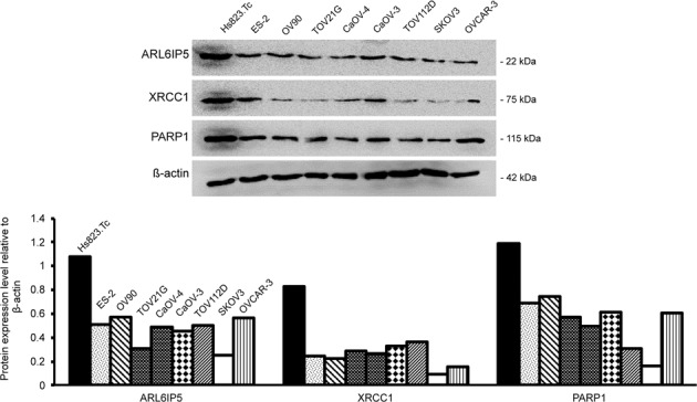 ARL6IP5, XRCC1, and PARP1 expression was analyzed by western blots in 8 OC cell lines, ES-2, OV-90, TOV21sG, CaOV-4, CaOV-3, TOV112D, SKOV3, OVCAR-3, and one normal ovarian cell line, Hs823.Tc.
