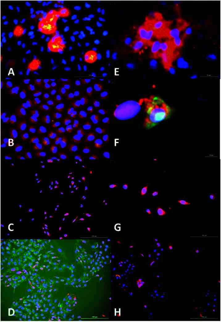 Fluorescence microscopy analysis of AC3 binding to SIRT1 enzyme and nuclei localisation. AC3-FAM (green-yellow), nuclei (DAPI, blue) and SIRT1 (Texas Red, red). Overlap of images can produced alterations in the colour results such as yellow produced by overlap of red and green, magenta produced by red and blue and cyan produced by green and blue. (A) A549, scale 100 μm. (B) HepG2 (augmentation in Fig. 20, ESI. (C) Caco2, scale 200 μm). (D) U2OS, scale 200 μm. (E) MCF7, scale 20 μm. (F) MCF7 zoomed. (G) MDAMB-468, scale 100 μm. (H) Beas2B, scale 200 μm. Fluorescence intensity was measured by LUMIStar luminometer microplate readers as: green ex. 495 nm, em. 509 nm; blue ex. 359 nm, em. 461 nm and red ex. 596 nm, em. 615 nm. The results represent the mean ± SEM of two different experiments performed twice. Images were taken at a magnification of 100× in a Cytation 3.