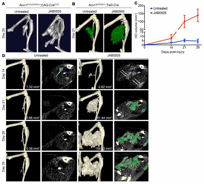 ( A ) Representative μCT images of HO in Acvr1 FLEx(R206H)/+ ; CAG-Cre ERT2 mice 20 days after cardiotoxin-induced injury of the gastrocnemius muscle (Untreated, n = 3; JAB0505, n = 4). ( B ) Representative μCT images of HO (pseudocolored green) in Acvr1 tnR206H/+ ; Tie2-Cre mice 21 days after pinch injury of the gastrocnemius muscle (Untreated, n = 11; JAB0505, n = 10). ( C ) Quantification of HO volumes as a function of time after muscle pinch injury of Acvr1 tnR206H/+ ; Tie2-Cre mice. Untreated, n = 11; JAB0505 (10 mg/kg), n = 6. Error bars represent ±SEM. **** P ≤ 0.0001 by 2-way ANOVA with Sidak’s multiple-comparison test. ( D ) Paired single transverse slice and 3D reconstructed μCT images of the distal hind limb of Acvr1 tnR206H/+ ; Tie2-Cre mice at the indicated times after hind limb muscle pinch injury with and without administration of JAB0505. Mineralized bone in the slice images is pseudocolored green. Radio-opaque lesional tissue below the threshold set for quantification of mineralized bone (white arrows in day 14 slices) is extensive at day 14 in JAB0505-treated mice. Mineralized bone in day 14 slices is barely visible at this magnification. HO volumes are given for images prior to day 35. The tibia and fibula are labeled with asterisks in the day 14 slices. Pelvic bones present in day 21, 28, and 35 slices of JAB0505-treated mice are denoted with arrowheads. To avoid confusion with HO, the baculum present in some images was removed by segmentation.