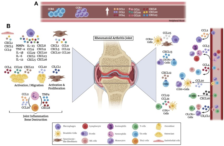 Chemokine involvement in the pathogenesis of rheumatoid arthritis.