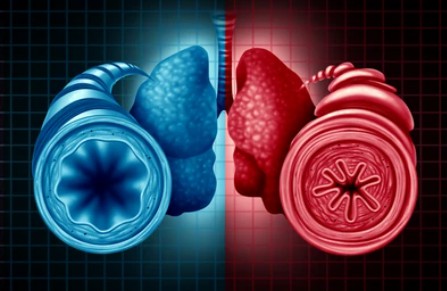 Asthma Therapeutic Targets - Creative BioMart