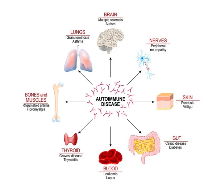 Autoimmune Disease Therapeutic Targets - Creative BioMart 