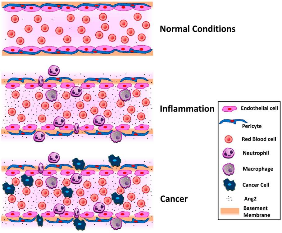 Schematic representation of the Ang2 effect on the vascular bed in normal conditions, inflammation, and cancer.