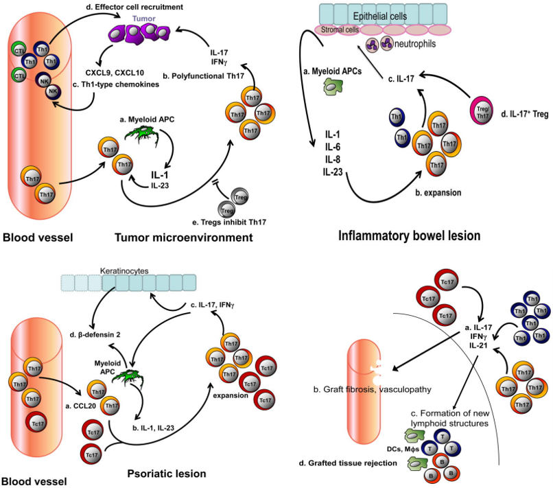 IL-17+ cells and cancer, inflammatory bowel disease (IBD), psoriasis, transplant.