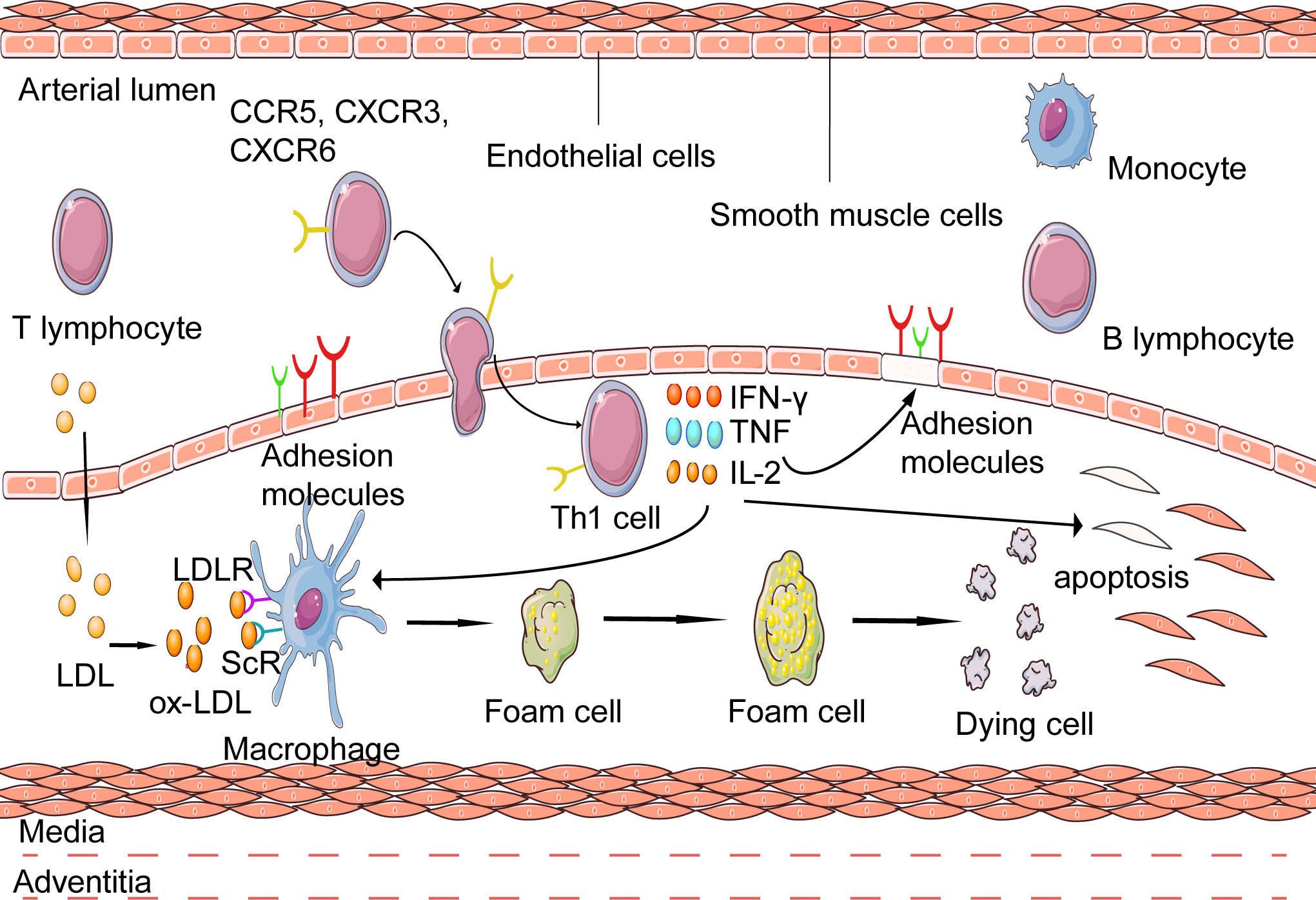 Activation of inflammatory response mediate by Th1 in atherosclerosis.