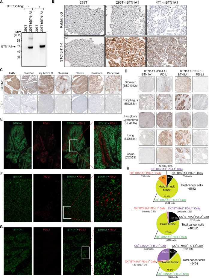 BTN1A and PD-L1 exhibit mutually exclusive expression in tumor cells.