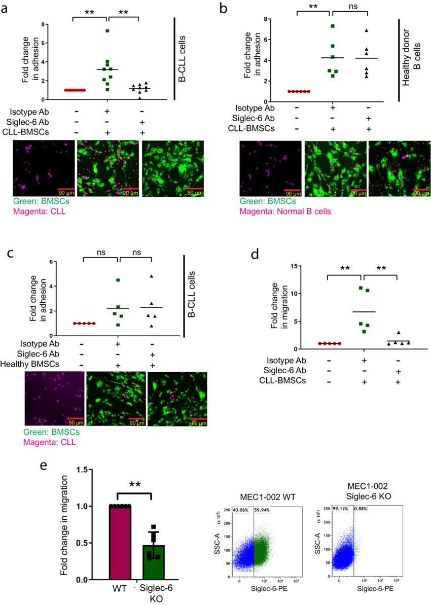 Siglec-6 promotes migration and adhesion of chronic lymphocytic leukemia (CLL) cells in vitro
