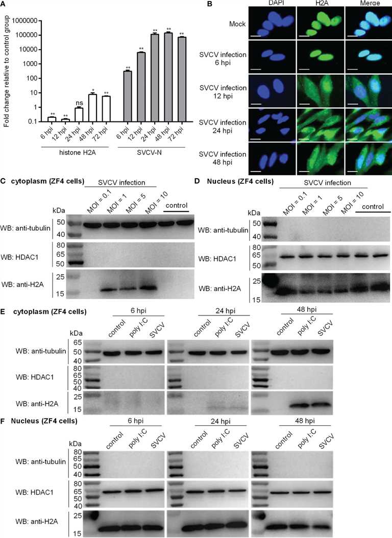 Expression and subcellular localization of zebrafish histone H2A.