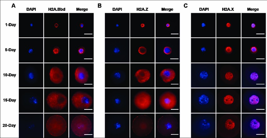 Localization and expression of histone H2A variants during mouse oogenesis.